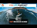 Episode - Brandon Scheid