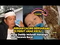 Download Lagu RIBUAN CACING BERSARANG DI PERUT ANAK KECIL! KANG DEDI MULYADI MENANGIS DAN KECEWA BERAT 😤😭