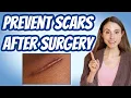 Download Lagu HOW TO PREVENT SCARS AFTER SURGERY 💉 DERMATOLOGIST @DrDrayzday