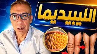 الليبيديما   في نظام الطيبات للبروفيسور ضياء العوضي  دندنها