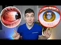 7 Eye Diseases That Can Steal Your Vision And How to Stop Them