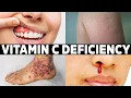 The 7 Signs You re Not Getting Enough Vitamin C