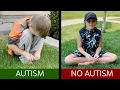 Lagu 5 Signs You DO NOT Have Autism