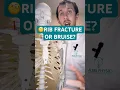 Broken Rib Or Bruised Rib How To Tell The Difference