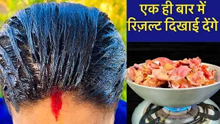 नारियल तेल में एक चुटकी इसे मिलाकर लगाने से सफ़ेद बाल बिलकुल जादू की तरह काले हो जाएंगे White Hair