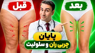 بهترین روش برای سوزاندن چربی داخل ران و از بین بردن سلولیت دندنها