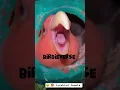 Download Lagu Common Lutino lovebirds breeding progress | Angry 😠 😡 lovebird female breeding progress #shorts