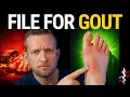 Gout and VA Disability The Secondary Claim Most Veterans With Diabetes Never File