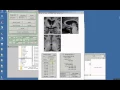 Setting origin for MRI image in SPM12