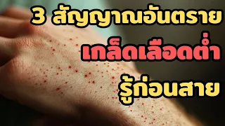 ควรไปพบแพทย์เมื่อใดหากสงสัยเกล็ดเลือดต่ำ