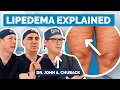 Download Lagu Lipedema vs Obesity: The Hidden Fat Disorder Doctors Miss