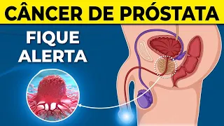 12 SINAIS DE CÂNCER DE PROSTATA | Dose de Saúde