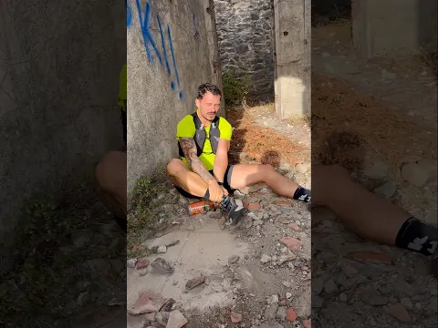 Fracture du tibia / Pas de diagonale