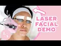 Lasers Did What to Her Face Laser Facial Demo