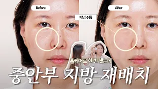 얼굴이 왜 자꾸 길어지지?😱 ‘중안부’ 때문입니다‼️ 집에서 줄이는 법