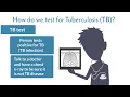 Understanding Tuberculosis Testing 4 of 5