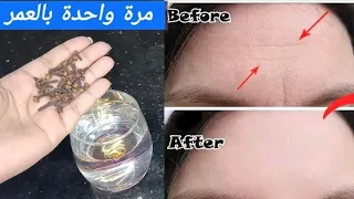 Mix Cloves with Water and Erase Wrinkles and Look like in your 20's, Cloves Mask