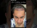 Download Lagu Kiki farel tanam rambut di Turki