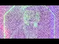 Ayaz Erdoğan - Milyon (Drknzdemir remix)