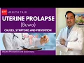 What causes Uterine Prolapse or Buwa
