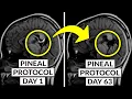 We Finally Know How To DECALCIFY The Pineal Gland