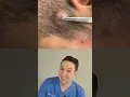 Download Lagu STUNNING - Watch this extraction with me!