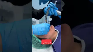 قبل العملية تخدير حامد محبی حامد محبي 