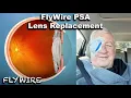 Can You See Better After Lens Replacement?