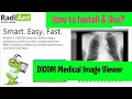 DICOM Images How to download install and use RadiAnt Viewer l ITFO