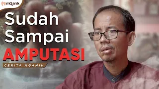 Download Jaringan Luka Mati, Pak Saefudin Sampai Amputasi MP3