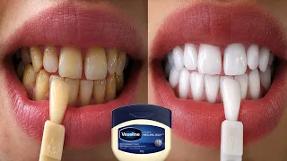 The secret dentists are hiding from you! It whitens teeth instantly and removes tartar.