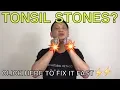 Download Lagu How to naturally get rid of tonsil stones