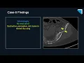 2022 QA Forum Part 1 Review 15 Minute Radiology CME