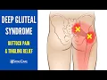 30 SECOND FIX Deep Gluteal Syndrome Buttock Pain Tingling Relief