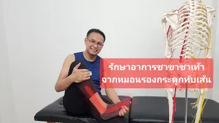 อาการปวดหลัง ปวดสะโพก และร้าวลงขา รวมถึงชาที่ฝ่าเท้าเกิดจากสาเหตุอะไร