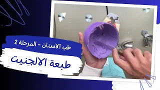 طريقة أخذ طبعة باستخدام مادة الألجينيت    طب اسنان مرحلة ثانية دندنها
