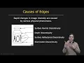 What is an Edge Edge Detection