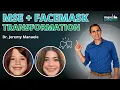 Watch This Jaw Transformation MSE Expansion Facemask in 3D