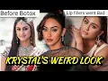 Lagu KRYSTAL DSOUZA BAD NOSE JOB \u0026 LIP FILLERS: GLORIFYING WEIRD BEAUTY STANDARDS \u0026 FAKE CONFIDENCE