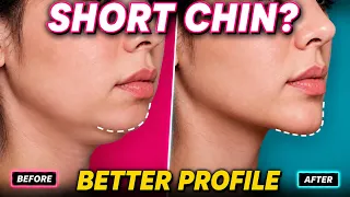 Short or Receding Chin? 5-Min Chin Sculpt for a Sharper Side Profile