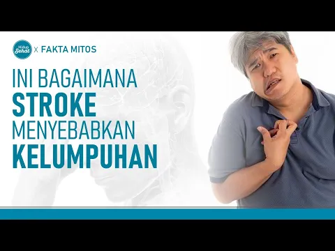 Dokter Jelaskan Bagaimana Stroke Sebabkan Kelumpuhan