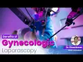 Benefits of Gynecologic Laparoscopy Dr Vimal Grover Senior Consultant Obs Gynae Expert Advise