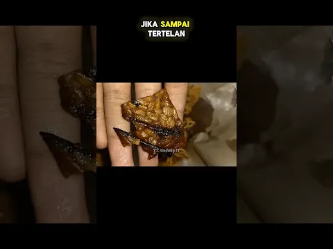 HAL ANEH YANG DITEMUKAN DALAM MAKANAN #fyp #gudangit