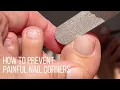 How to prevent painful nails by rounding off nail corners thin diamond file