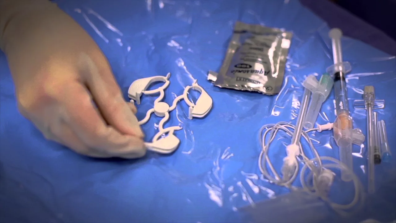 Ultrasound-Guided Peripheral Nerve Blocks Using Infiniti Plus Needle Guide