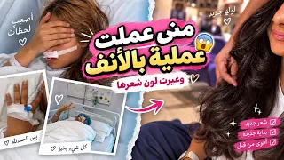     منى عملت عملية بالأنف… وبعدها غيرت لون شعرها😳