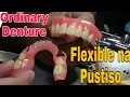 Lower Flexible Denture and Upper Partial Denture How you like That Denture in the Philippines