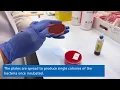 Microbiology - Blood culture