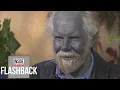 Why This Man s Skin Turned Blue