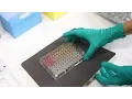 Download Lagu Conceptos básicos de la técnica ELISA. Protocolo del ELISA en Sandwich.